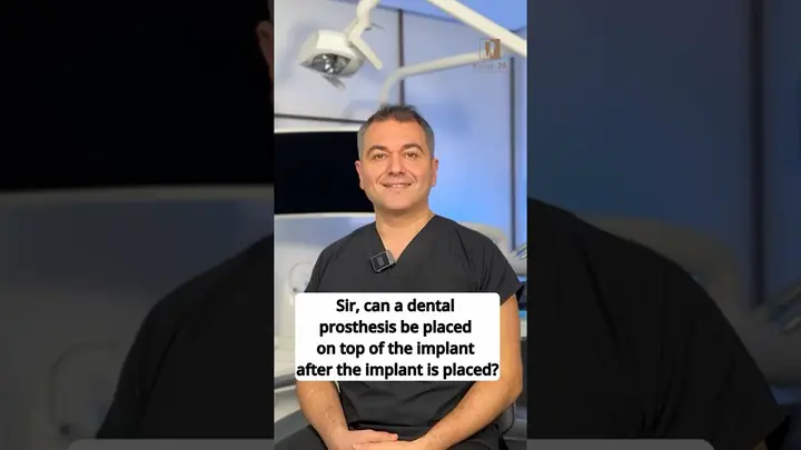 Can the upper bridge be fitted in the same session as the implants?