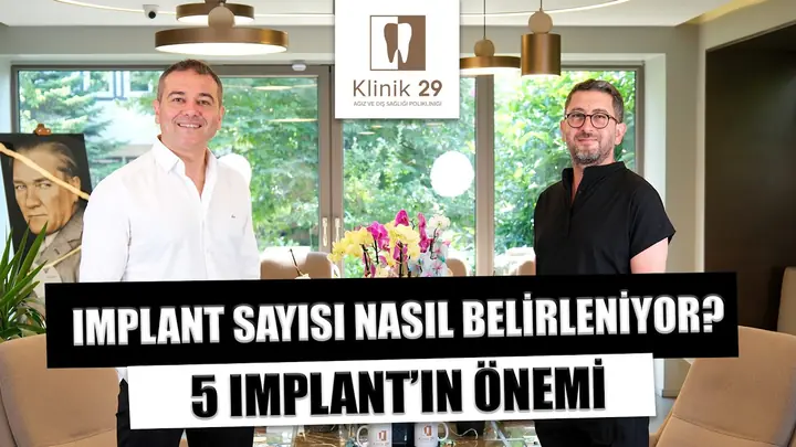 How is the number of implants decided?